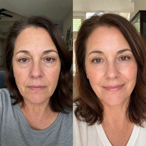 Anti-Aging GHKCu Serum