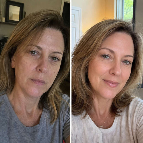 Anti-Aging GHKCu Serum